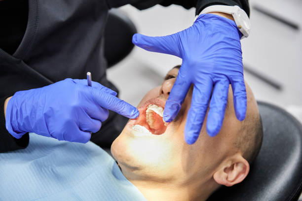 Best Emergency Root Canal Treatment in Albany, MN